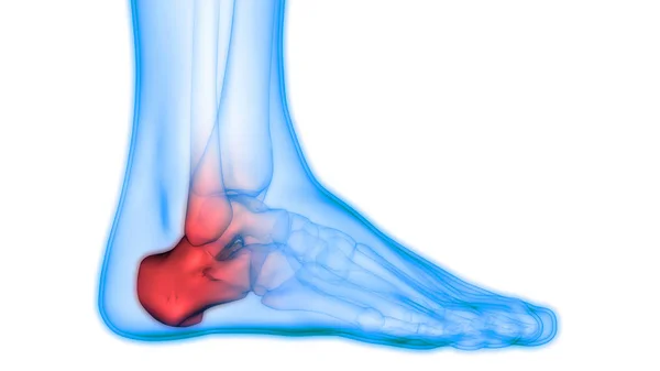 Ludzkie Bóle Stawów Kostnych Stawów Nóg Ilustracja — Zdjęcie stockowe