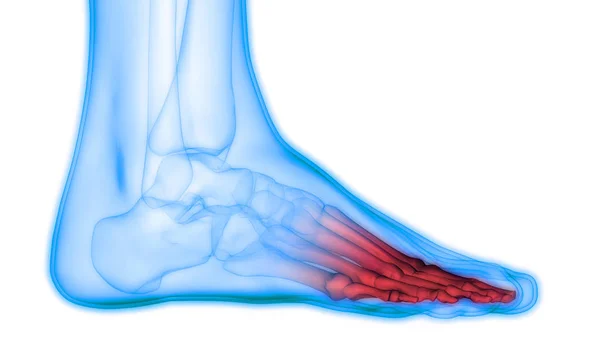 Ludzkie Bóle Stawów Kostnych Stawów Nóg Ilustracja — Zdjęcie stockowe