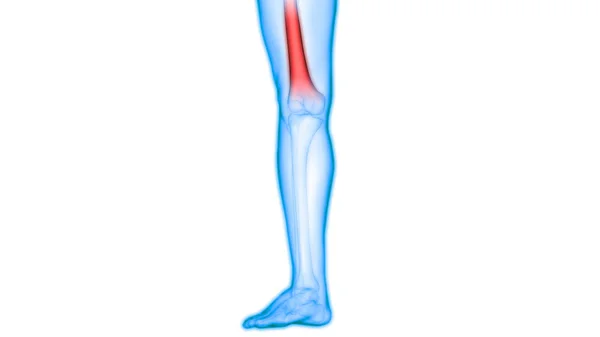 Human Body Bone Joint Pains Illustration — стокове фото