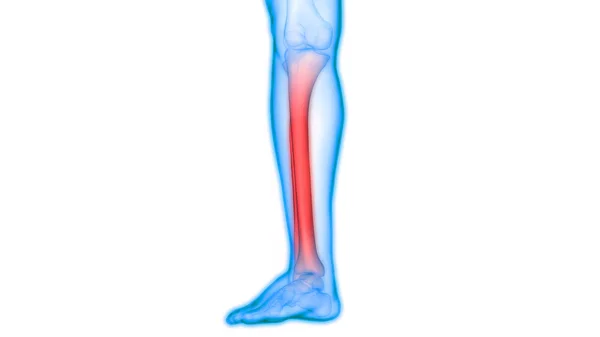 人体骨关节痛 Leg Joint — 图库照片