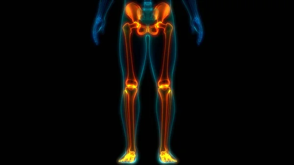 Pijn Gewrichtspijn Van Het Menselijk Lichaam Benen Gewrichten Met Heup — Stockfoto
