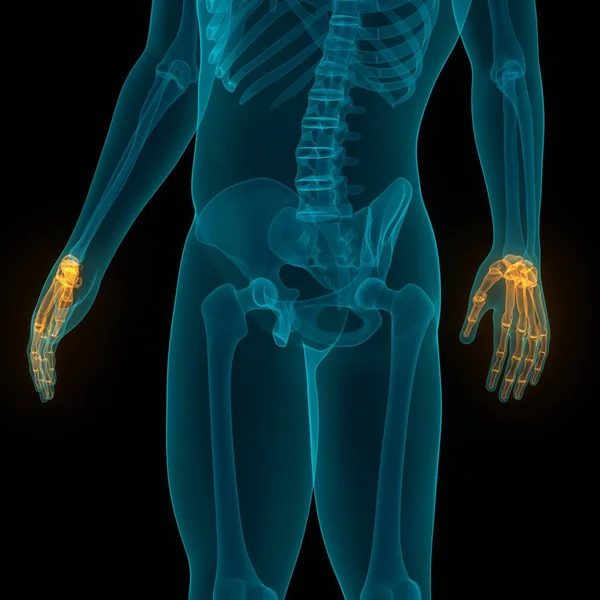 Anatomia Dos Ossos Sistema Esqueleto Humano Mãos — Fotografia de Stock