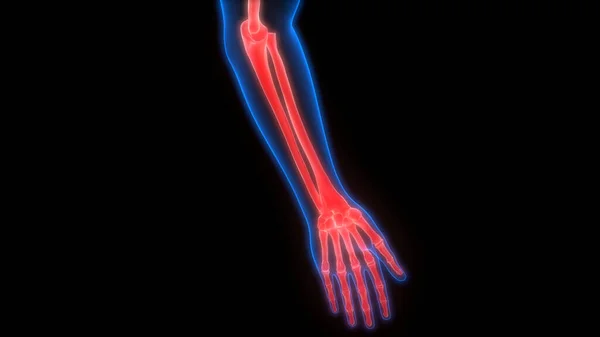 Ανθρώπινος Σκελετός Οστών Αρθρώσεων Πόνους Ανατομία Χέρι Άρθρωση — Φωτογραφία Αρχείου