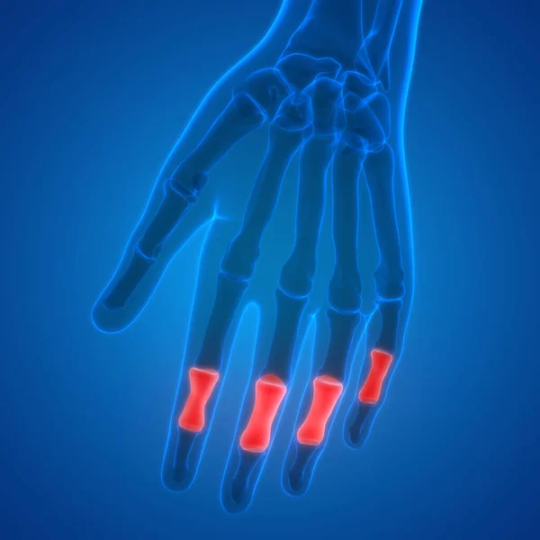 Human Skeleton System Palm Hand Bone Joints Anatomy 약자입니다 — 스톡 사진