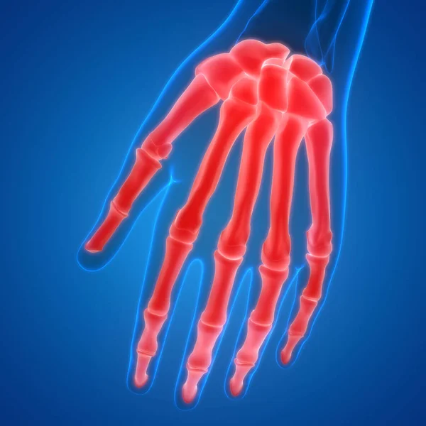 Human Skeleton System Palm Hand Bone Joints Anatomy — Stock Photo, Image