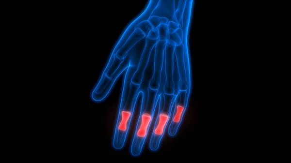 Human Skeleton Bone Joint Pains Anatomy Handgewricht — Stockfoto