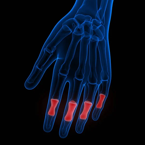 Ludzki Szkielet Bóle Stawów Anatomia Stawów Dłoni — Zdjęcie stockowe