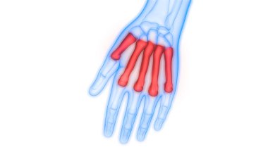 İnsan iskelet sistemi, Metakarpal Kemik Eklemleri Anatomisi. Üç Boyut