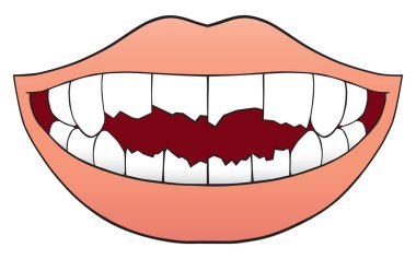 Mouth Full of Broken Teeth clipart