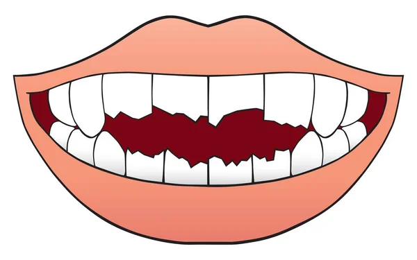 Рот полон сломанных зубов — стоковый вектор
