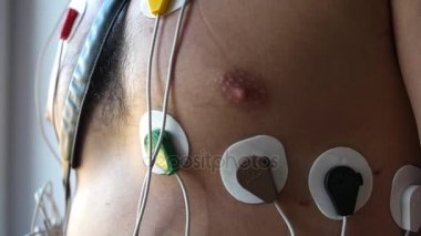 11.4.2017 Novosibirsk, Rusya Federasyonu. Mens göğsünden kalp için sensörler holter. HD, 1920 x 1080, ağır çekim