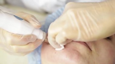 Elmas mikrodermabrazyon, kozmetik güzellik spa kliniğinde tedavi soyulması. kadın bir vakum mikrodermabrazyon yordam Başlarken