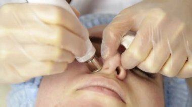 Elmas mikrodermabrazyon, kozmetik güzellik spa kliniğinde tedavi soyulması. kadın bir vakum mikrodermabrazyon yordam Başlarken