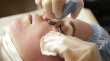 Elmas mikrodermabrazyon, kozmetik güzellik spa kliniğinde tedavi soyulması. kadın bir vakum mikrodermabrazyon yordam Başlarken