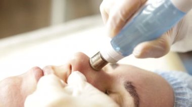 Elmas mikrodermabrazyon, kozmetik güzellik spa kliniğinde tedavi soyulması. kadın bir vakum mikrodermabrazyon yordam Başlarken