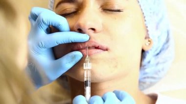 Dudak büyütme bir klinikte genç kadın. Anestezik enjeksiyon silikon implant kalınlaşma dudaklar. Botox enjeksiyon