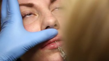 Dudak büyütme bir klinikte genç kadın. Anestezik enjeksiyon silikon implant kalınlaşma dudaklar. Botox enjeksiyon
