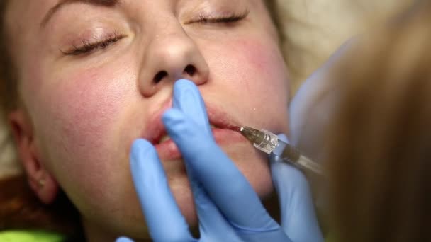 Mujer joven en labio Aumento en una clínica. Inyección anestésica Engrosamiento de labios con implante de silicona. inyección de botox — Vídeos de Stock