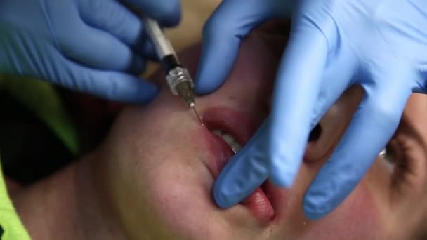 Jovem em lábio Aumento em uma clínica. Injeção anestésica Implante de silicone espessamento dos lábios. botox injetável — Vídeo de Stock