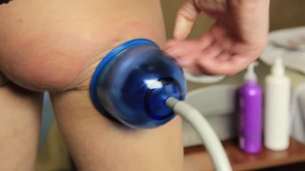 Frau hat eine Vakuumwalze Massage Schlankheits-Problemzonen. Professionelle Ausrüstung für kosmetische Klinik. — Stockvideo