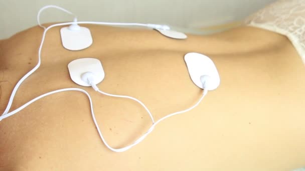 Profesionální elektroterapie na těle ženy. svalové kontrakce pod vlivem elektrického proudu. Detail pacientů zpět — Stock video