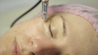 güzel kadın kozmetik ilaç tedavi görüyor. Şevval Özçelik Güzellik yüz bir güzel kız yüz, temizlik yaparken su jeti ile cilt temizliği