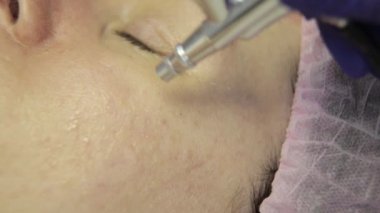 güzel kadın yüz cilt tedavi görüyor. Şevval Özçelik Güzellik yüz bir güzel kız yüz, temizlik yaparken su jeti ile cilt temizliği