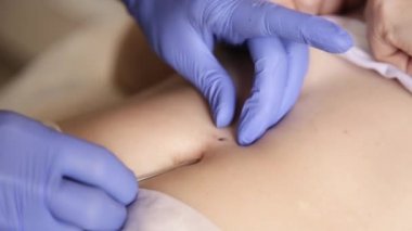 Göbek piercing yüklemek için işlem. Doktor ponksiyon göbek yapıyor