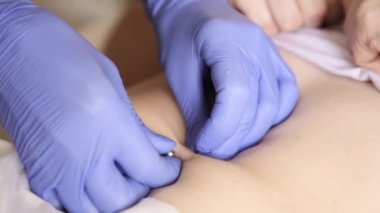 Göbek piercing yüklemek için işlem. Doktor ponksiyon göbek yapıyor