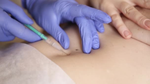 Operazione per installare il piercing all'ombelico. medico fa puntura dell'ombelico — Video Stock