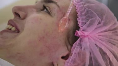 Elektrik darsonval yüz masaj yordamı. Güzellik Salonu bir kız darsonvalization yüzü