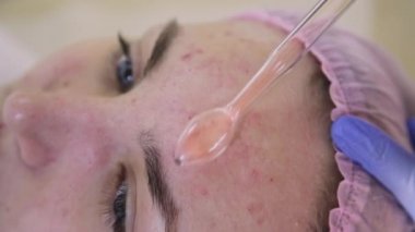 Elektrik darsonval yüz masaj yordamı. Güzellik Salonu bir kız darsonvalization yüzü