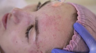 Elektrik darsonval yüz masaj yordamı. Güzellik Salonu bir kız darsonvalization yüzü