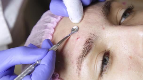 Espremendo tratamentos de acne espinha. Jovem mulher recebendo beleza terapia facial de limpeza espinha . — Vídeo de Stock