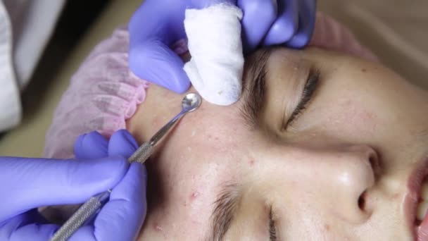 Esteticista apretando espinillas espinillas para jóvenes wonan en el salón de belleza. cuidado facial de piel — Vídeos de Stock