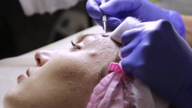 Şevval Özçelik Güzellik Güzellik salonunda genç kazanmıştı için sivilce siyah nokta sıkma. Yüz Cilt Bakımı