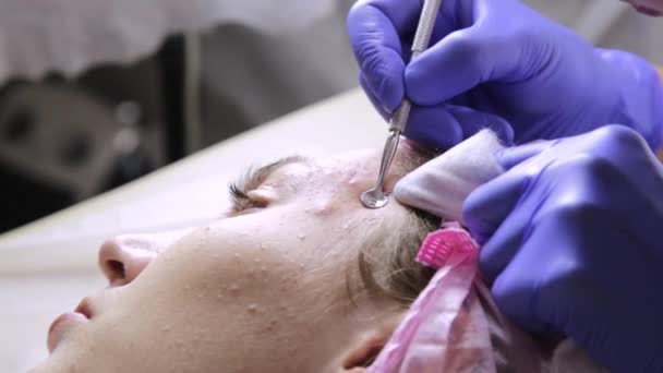 Kosmetikerin quetscht Pickel Mitesser für junge wonan in Schönheitssalon. Gesichtspflege — Stockvideo