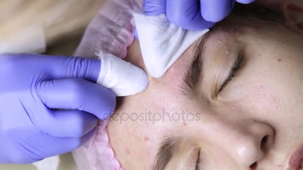Espremendo tratamentos de acne espinha. Jovem mulher recebendo beleza terapia facial de limpeza espinha . — Vídeo de Stock