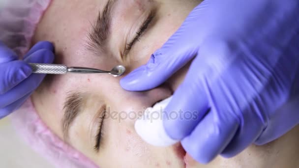 Exprimir los tratamientos del acné espinilla. Mujer joven recibiendo terapia facial de belleza de espinilla de limpieza . — Vídeos de Stock