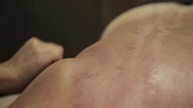 acupressure ile sıyırıcı guaj erkek bir sırt. Çin alternatif tıp