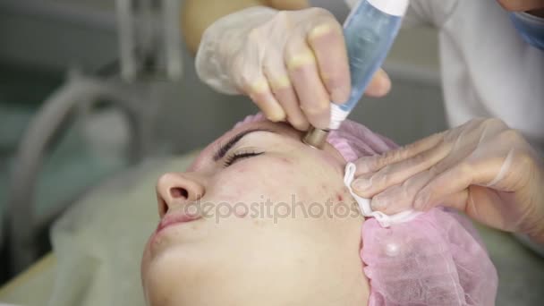 Ung kvinna med problemhud att få en kosmetiska behandlingar med medicinsk utrustning — Stockvideo