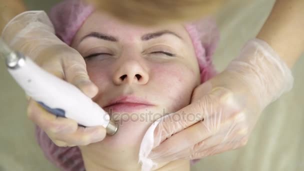 Esteticista fazendo limpeza facial com equipamentos de cosmetologia para espinha menina — Vídeo de Stock