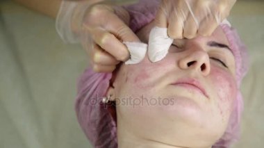 Sıkma sivilce akne tedavisi. Genç kadın Güzellik yüz tedavi sivilce temizleme alan.