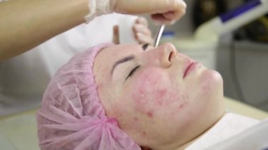 Yüz Cilt maskesi ile temizlik kozmetik tıp muamele kadın