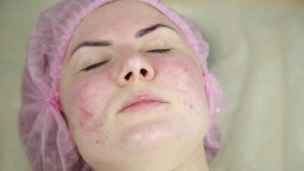 Frau erhält eine kosmetische Behandlung, Reinigung der Gesichtshaut mit Maske — Stockvideo