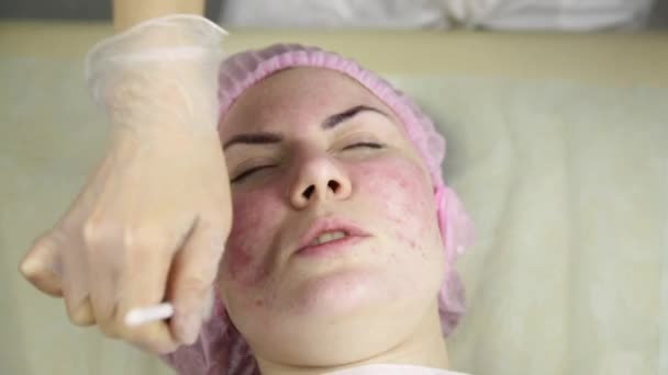 Frau erhält eine kosmetische Behandlung, Reinigung der Gesichtshaut mit Maske — Stockvideo