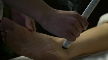 Geleneksel Çin tıbbı akupunktur süreç. Çince Geleneksel tedavi, Isıtma vücudun gelin