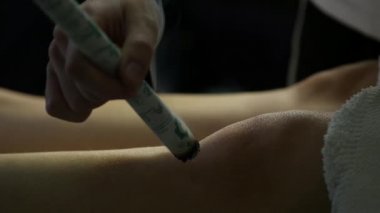 Geleneksel Çin tıbbı akupunktur süreç. Çince Geleneksel tedavi, Isıtma vücudun gelin