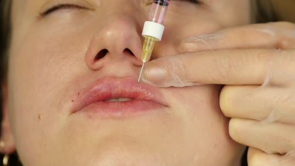 Процесс наращивания губ гиалуроновой кислоты. пациент во время инъекции губ. замедленное движение — стоковое видео