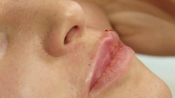 Güzellik uzmanı kadının dudakları içine enjeksiyon yapmak. dudak büyütme ve plastik cerrahi. 4k — Stok video